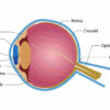 Can LASIK Eye Surgery Cure Glaucoma?