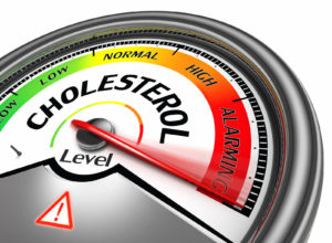 Is There a Connection Between Cholesterol and Cataracts?