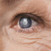 The Big Three: Protecting Your Vision Against Glaucoma, Cataracts, and Macular Degeneration