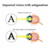 Ways You Can Naturally Improve Poor Vision Caused by Astigmatism