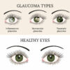 Natural Ways to Lower Eye Pressure