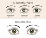 Natural Ways to Lower Eye Pressure