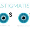 Improve Astigmatism Naturally Image