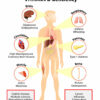 Vitamin Deficiencies and Vision Loss