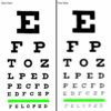 Eye Exercises for People with Different Prescriptions for Each Eye