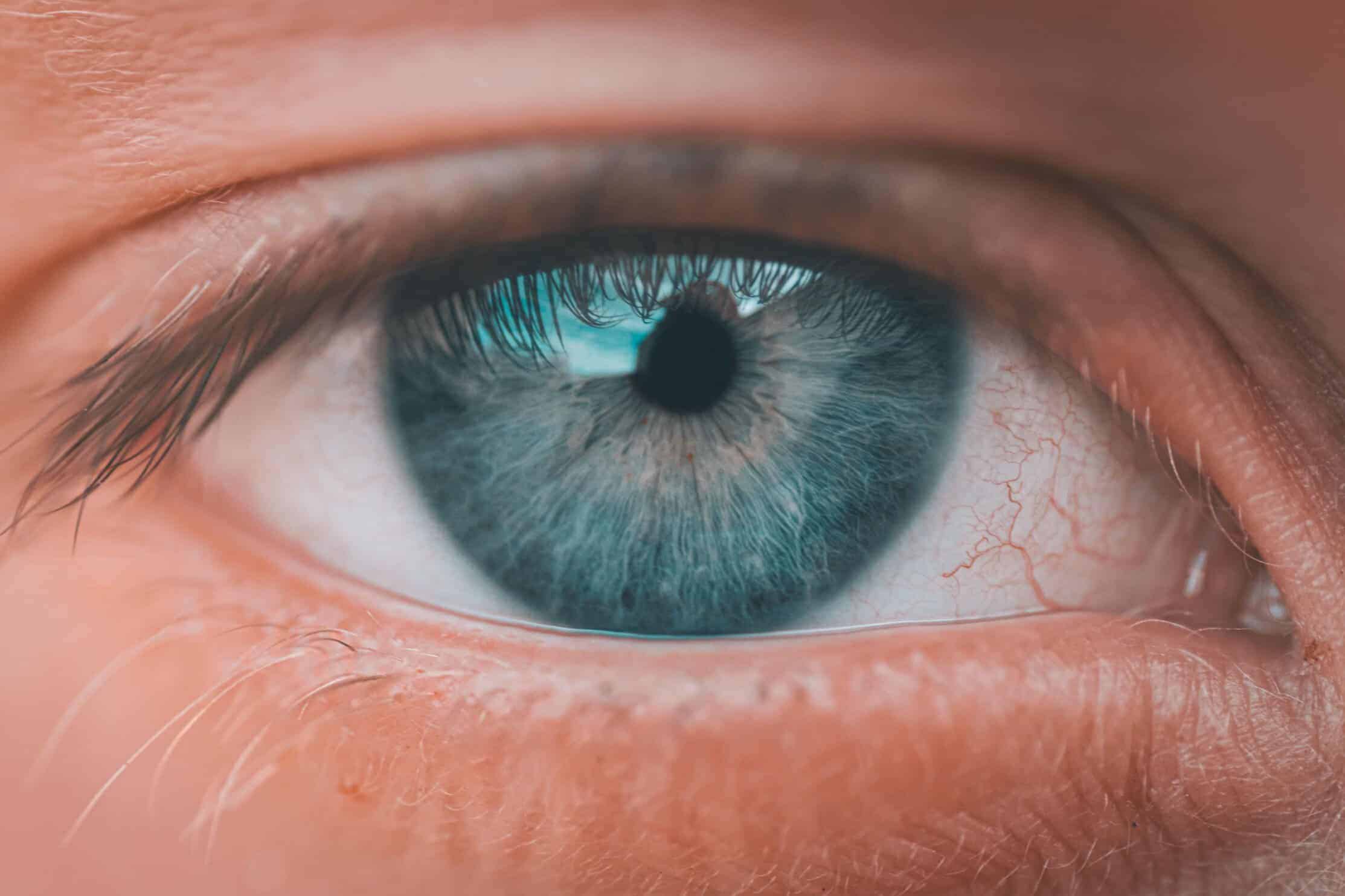Can Glaucoma Be Prevented? What You Can Do to Protect Your Vision